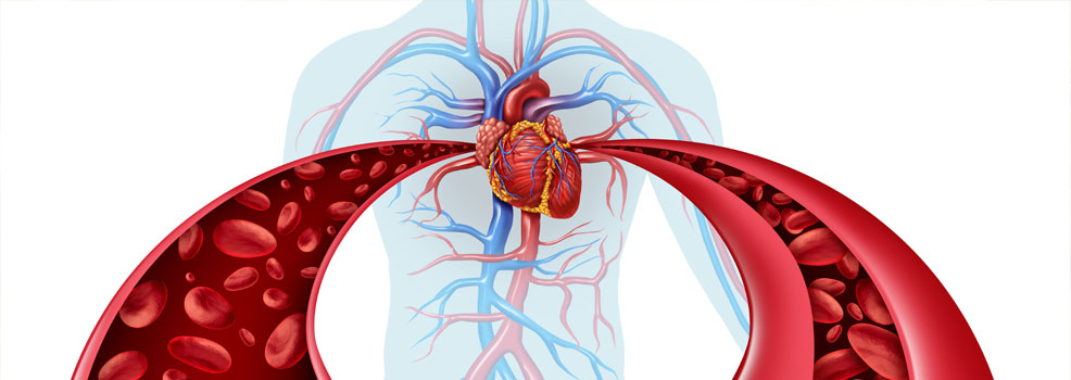 Hypertension and high blood pressure