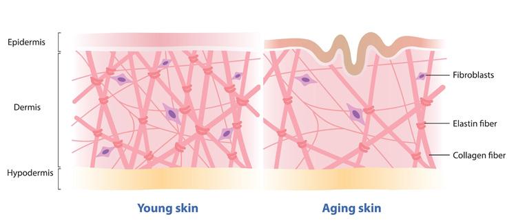young vs aging skin parts