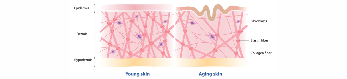 young vs aging skin parts