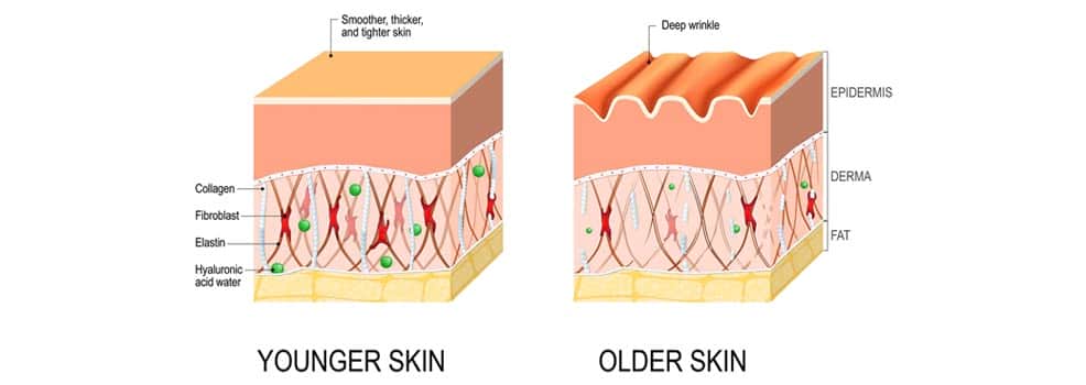 Skin layer illustration of younger skin and older skin.